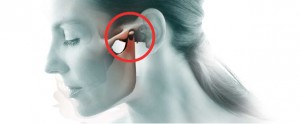 que es el sindrome de disfuncion temporo mandibular atm